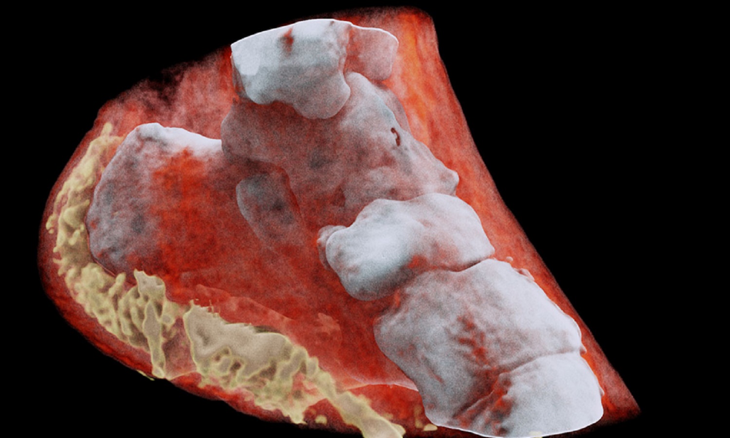 Las primeras radiografías a colores del cuerpo humano son realmente asombrosas