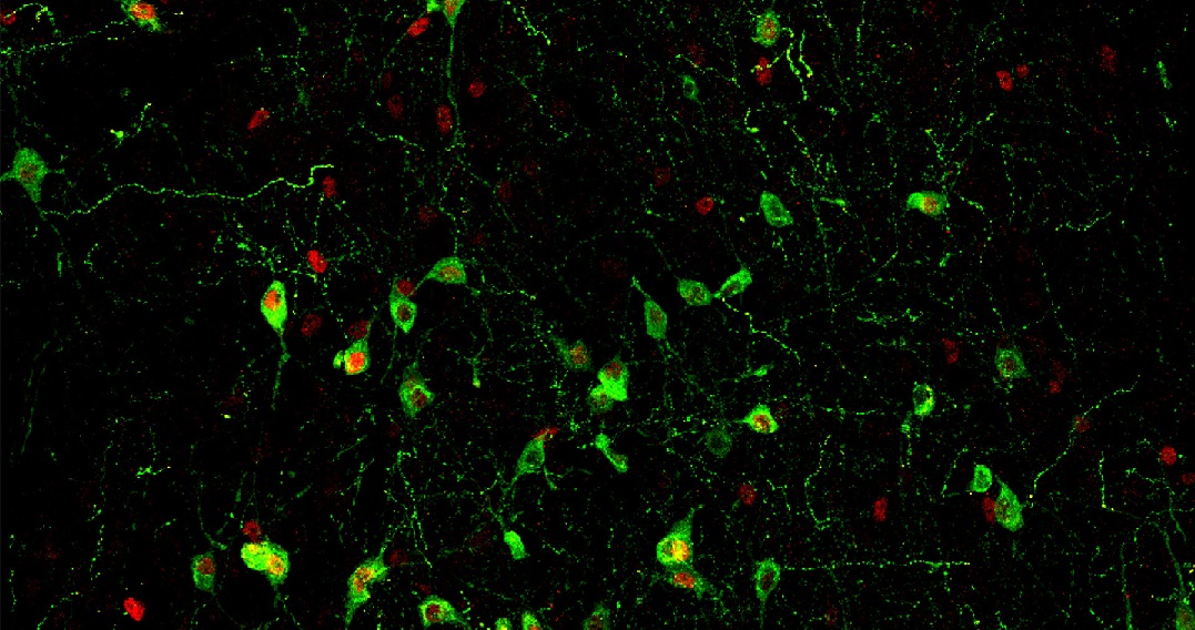 Un circuito cerebral vincula el estrés, el sueño y el sistema inmunológico, revela estudio con ratones