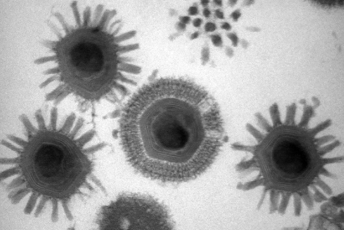 Los virus gigantes podrían ayudar a entender la evolución de las células con núcleo