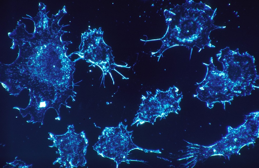 Algunas células cancerígenas pueden “hibernar” para sobrevivir a las quimioterapias