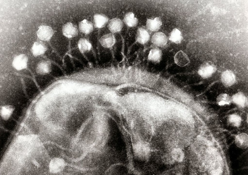 Estudio encuentra 70 mil virus desconocidos en los intestinos humanos