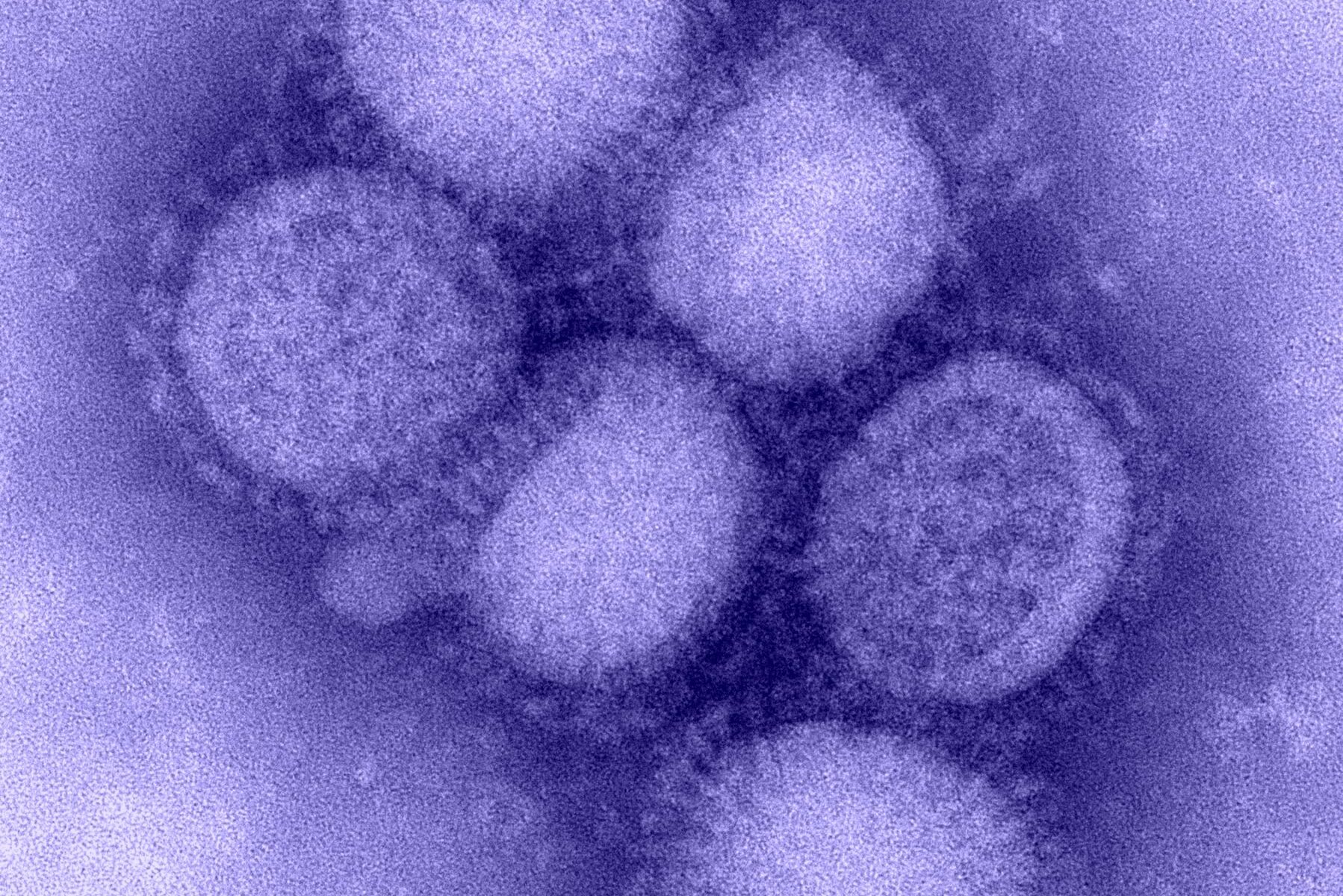 Medidas contra la pandemia han reducido la diversidad de virus de la influenza
