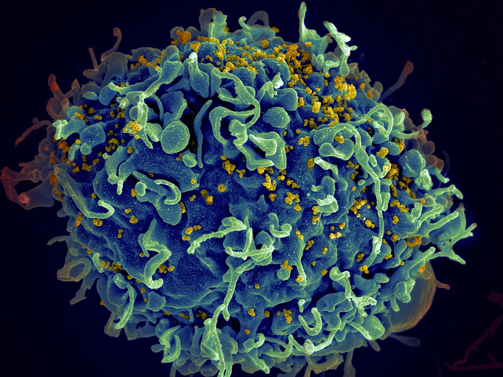 Esta semana Moderna comienza los ensayos de su vacuna experimental contra el VIH