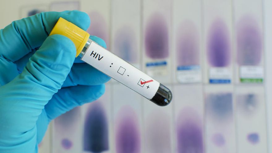 Una mujer se convierte en la segunda paciente de VIH que ha eliminado al virus sin tratamiento