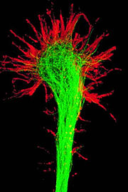 Las células se desplazan usando filamentos y científicos descubren cómo funcionan