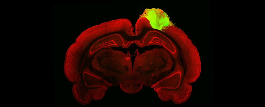 Gran hito biotecnológico: Pequeños cerebros humanos fueron transplantados a ratas