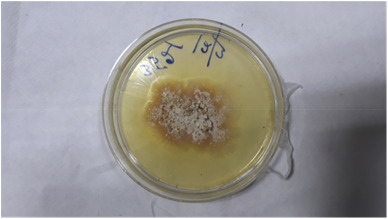 Se registra el primer caso de infección en humanos por el «hongo asesino de árboles»